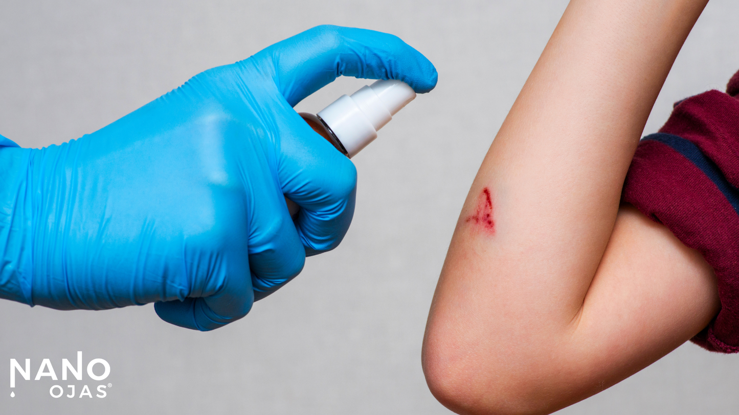 How Do You Disinfect Minor Wounds Naturally?