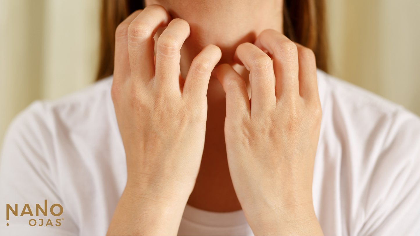 Histamine Response on Skin: What It Looks Like and How to Calm It Naturally